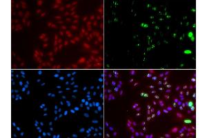 Immunofluorescence analysis of GFP-RNF168 transgenic U2OS cell using XPA antibody. (XPA anticorps)