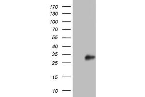 Western Blotting (WB) image for anti-Adiponectin (ADIPOQ) (AA 19-244) antibody (ABIN2715779) (ADIPOQ anticorps  (AA 19-244))