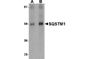 Western blot analysis of SQSTM1 in Human spleen tissue lysate with SQSTM1 antibody at (A) 1 and (B) 2 µg/mL. (SQSTM1 anticorps  (C-Term))