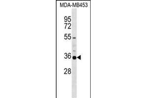 KCNA5 Antibody (C-term) (ABIN1537420 and ABIN2848693) western blot analysis in MDA-M cell line lysates (35 μg/lane). (KCNA5 anticorps  (C-Term))