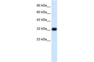 Western Blotting (WB) image for anti-Chromosome 22 Open Reading Frame 31 (C22orf31) antibody (ABIN2461056) (C22orf31 anticorps)