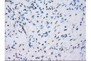 Immunohistochemical staining of paraffin-embedded prostate tissue using anti-FCGR2A mouse monoclonal antibody. (FCGR2A anticorps)