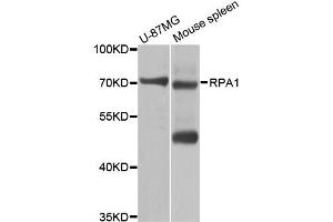 Western blot analysis of extracts of various cell lines, using RPA1 antibody (ABIN5970378) at 1/1000 dilution. (RPA1 anticorps)