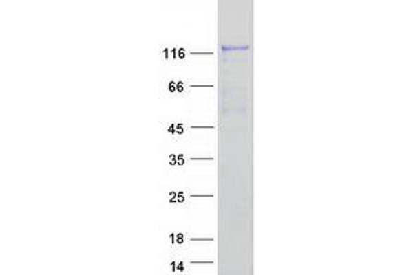 ABL2 Protein (ABL2) (Transcript Variant A) (Myc-DYKDDDDK Tag)