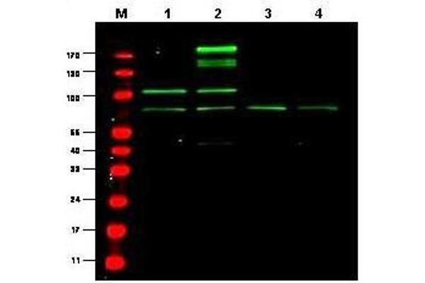 RREB1 anticorps