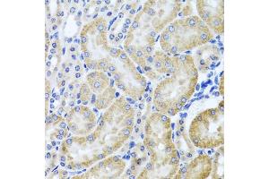 Immunohistochemistry of paraffin-embedded mouse kidney using HDAC6 antibody (ABIN5970867) at dilution of 1/100 (40x lens). (HDAC6 anticorps)