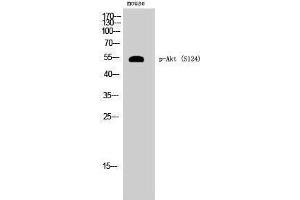 Western Blotting (WB) image for anti-V-Akt Murine Thymoma Viral Oncogene Homolog 1 (AKT1) (pSer124) antibody (ABIN6284601) (AKT1 anticorps  (pSer124))