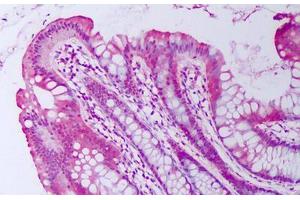 Anti-BMP2 antibody IHC staining of human colon, epithelium. (BMP2 anticorps)