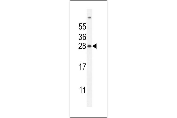 UBD anticorps  (C-Term)