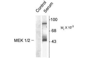 Image no. 1 for anti-Mitogen-Activated Protein Kinase Kinase 1 (MAP2K1) (pSer218), (Ser222) antibody (ABIN221121) (MEK1 anticorps  (pSer218, Ser222))