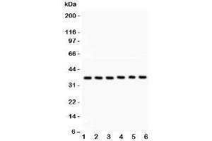 Western blot testing of Heme Oxygenase 2 antibody and Lane 1:  rat kidney;  2: human A549;  3: (h) COLO320;  4: (h) MM231;  5: (h) HeLa;  6: (h) SKOV. (HMOX2 anticorps  (AA 2-316))