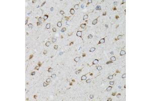 Immunohistochemistry of paraffin-embedded rat brain using UBE2D1 antibody (ABIN5971011) at dilution of 1/100 (40x lens). (UBE2D1 anticorps)