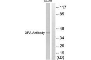Western Blotting (WB) image for anti-Xeroderma Pigmentosum, Complementation Group A (XPA) (AA 211-260) antibody (ABIN2889290) (XPA anticorps  (AA 211-260))