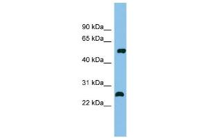 WB Suggested Anti-MEF2D Antibody Titration: 0. (MEF2D anticorps  (Middle Region))