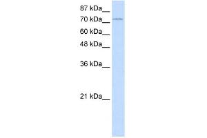 WB Suggested Anti-ZNF441 Antibody Titration:  1. (ZNF441 anticorps  (N-Term))