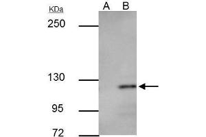 Immunoprecipitation (IP) image for anti-Cadherin 1, Type 1, E-Cadherin (Epithelial) (CDH1) antibody (ABIN2854751)