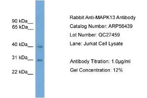 WB Suggested Anti-MAPK13  Antibody Titration: 0. (MAPK13 anticorps  (Middle Region))