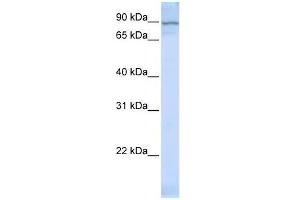 Western Blot showing ZNF598 antibody used at a concentration of 1-2 ug/ml to detect its target protein. (ZNF598 anticorps  (Middle Region))