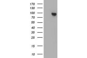 Western Blotting (WB) image for anti-Catenin (Cadherin-Associated Protein), beta 1, 88kDa (CTNNB1) antibody (ABIN1496895) (CTNNB1 anticorps)