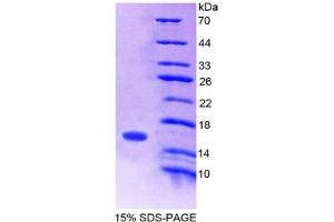 Image no. 1 for Secretin (SECR) (AA 26-133) protein (His tag) (ABIN4988591) (Secretin Protein (SECR) (AA 26-133) (His tag))