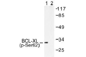 Image no. 1 for anti-BCL2-Like 1 (BCL2L1) (pSer62) antibody (ABIN317973) (BCL2L1 anticorps  (pSer62))