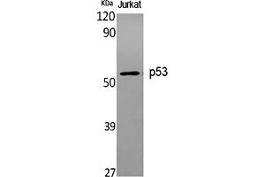 Western Blot analysis of various cells using p53 Polyclonal Antibody diluted at 1:1000. (p53 anticorps)