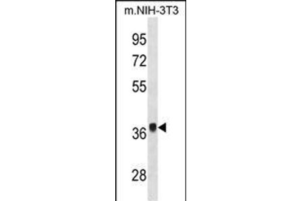 FGF8 anticorps  (N-Term)