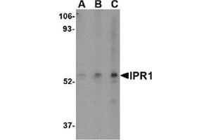 Western blot analysis of IPR1 in Hela cell lysate with IPR1 antibody at (A) 0. (SP110 anticorps  (C-Term))