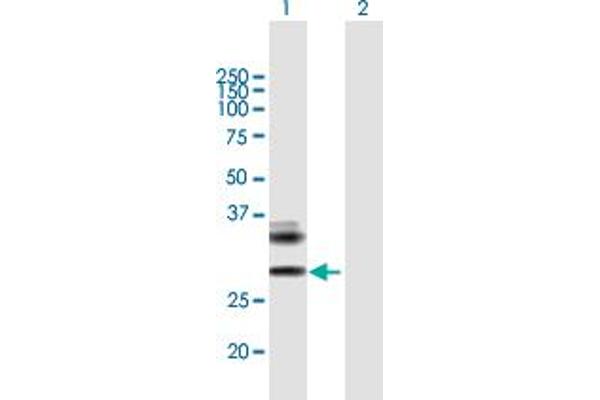 Retinoic Acid Early Transcript 1E (RAET1E) (AA 1-263) anticorps