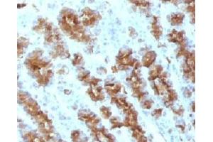 Immunohistochemistry (Formalin-fixed Paraffin-embedded Sections) (IHC (fp)) image for anti-Tumor Necrosis Factor alpha (TNF alpha) antibody (ABIN3023860)