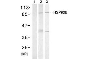 Western blot analysis of extract from HeLa cells, untreated or treated with UV or Heat shock, using HSP90B (Ab-254) antibody (E021290). (HSP90AB1 anticorps)