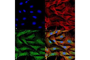 Immunocytochemistry/Immunofluorescence analysis using Mouse Anti-Copper Transporting ATPase 1 Monoclonal Antibody, Clone S60-4 . (ATP7A anticorps  (AA 42-61) (FITC))