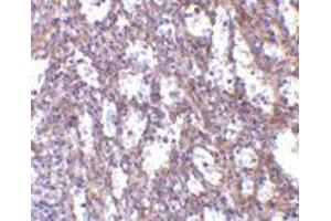 Immunohistochemistry of IL-32 in human spleen tissue with IL-32 antibody at 10 μg/ml. (IL32 anticorps  (C-Term))