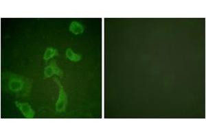 Immunofluorescence (IF) image for anti-Interleukin 2 Receptor, beta (IL2RB) (AA 331-380) antibody (ABIN2888883) (IL2 Receptor beta anticorps  (AA 331-380))