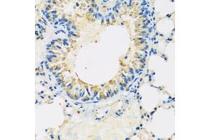 Immunohistochemistry of paraffin-embedded mouse lung using ABCF2 antibody. (ABCF2 anticorps)