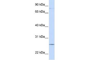 PCDHGC3 antibody used at 1 ug/ml to detect target protein. (Protocadherin gamma Subfamily C, 3 (PCDHGC3) (N-Term) anticorps)