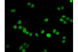 Immunofluorescence staining of Hela cells with ABIN7139605 at 1:7. (HIST1H4A anticorps  (meLys59))