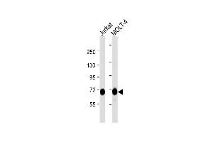 All lanes : Anti-Z Antibody  at 1:1000 dilution Lane 1: Jurkat whole cell lysate Lane 2: MOLT-4 whole cell lysate Lysates/proteins at 20 μg per lane. (ZAP70 anticorps  (AA 252-282))