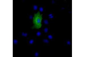 Immunofluorescence (IF) image for anti-Epoxide Hydrolase 2, Cytoplasmic (EPHX2) antibody (ABIN1500857) (EPHX2 anticorps)