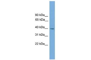 WB Suggested Anti-Tmem130 Antibody Titration:  0. (TMEM130 anticorps  (Middle Region))
