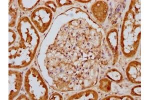 IHC image of ABIN7127689 diluted at 1:100 and staining in paraffin-embedded human kidney tissue performed on a Leica BondTM system. (Recombinant EIF2AK2 anticorps  (pThr446))
