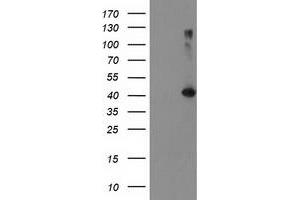 Western Blotting (WB) image for anti-TBC1 Domain Family, Member 21 (TBC1D21) antibody (ABIN1501314) (TBC1D21 anticorps)