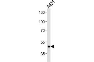 Western Blotting (WB) image for anti-Fibrinogen gamma Chain (FGG) antibody (ABIN3003142) (FGG anticorps)