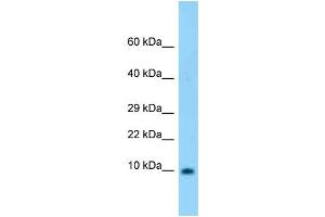 WB Suggested Anti-S100b Antibody Titration: 1. (S100B anticorps  (N-Term))