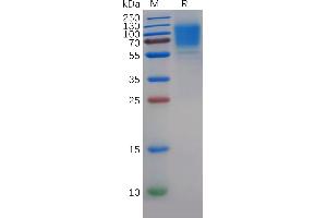 Human GC Protein, His Tag on SDS-PAGE under reducing condition. (GUCY2C Protein (AA 24-430) (His tag))