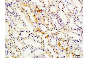 Immunohistochemistry (Paraffin-embedded Sections) (IHC (p)) image for anti-S100 Calcium Binding Protein A4 (S100A4) (AA 15-101) antibody (ABIN703706)