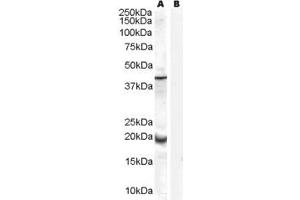 Western Blotting (WB) image for anti-Glutathione Peroxidase 7 (GPX7) (Internal Region) antibody (ABIN2465788) (Glutathione Peroxidase 7 anticorps  (Internal Region))