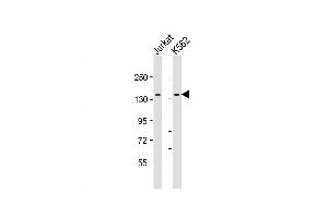 Western Blot at 1:2000 dilution Lane 1: Jurkat whole cell lysate Lane 2: K562 whole cell lysate Lysates/proteins at 20 ug per lane. (TACC3 anticorps  (AA 498-530))