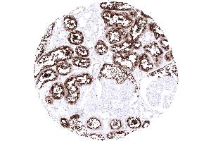 Kidney cortex A strong ACE2 immunostaining occurs in proximal tubuli of the kidney (Recombinant ACE2 anticorps  (AA 705-805))