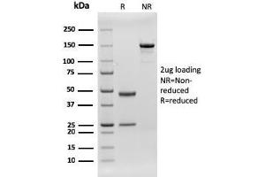 SDS-PAGE Analysis Purified CD79b Recombinant Mouse Monoclonal Antibody (rIGB/1842). (Recombinant CD79b anticorps  (AA 29-159))